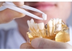 Протезирование зубов в Denta Vi